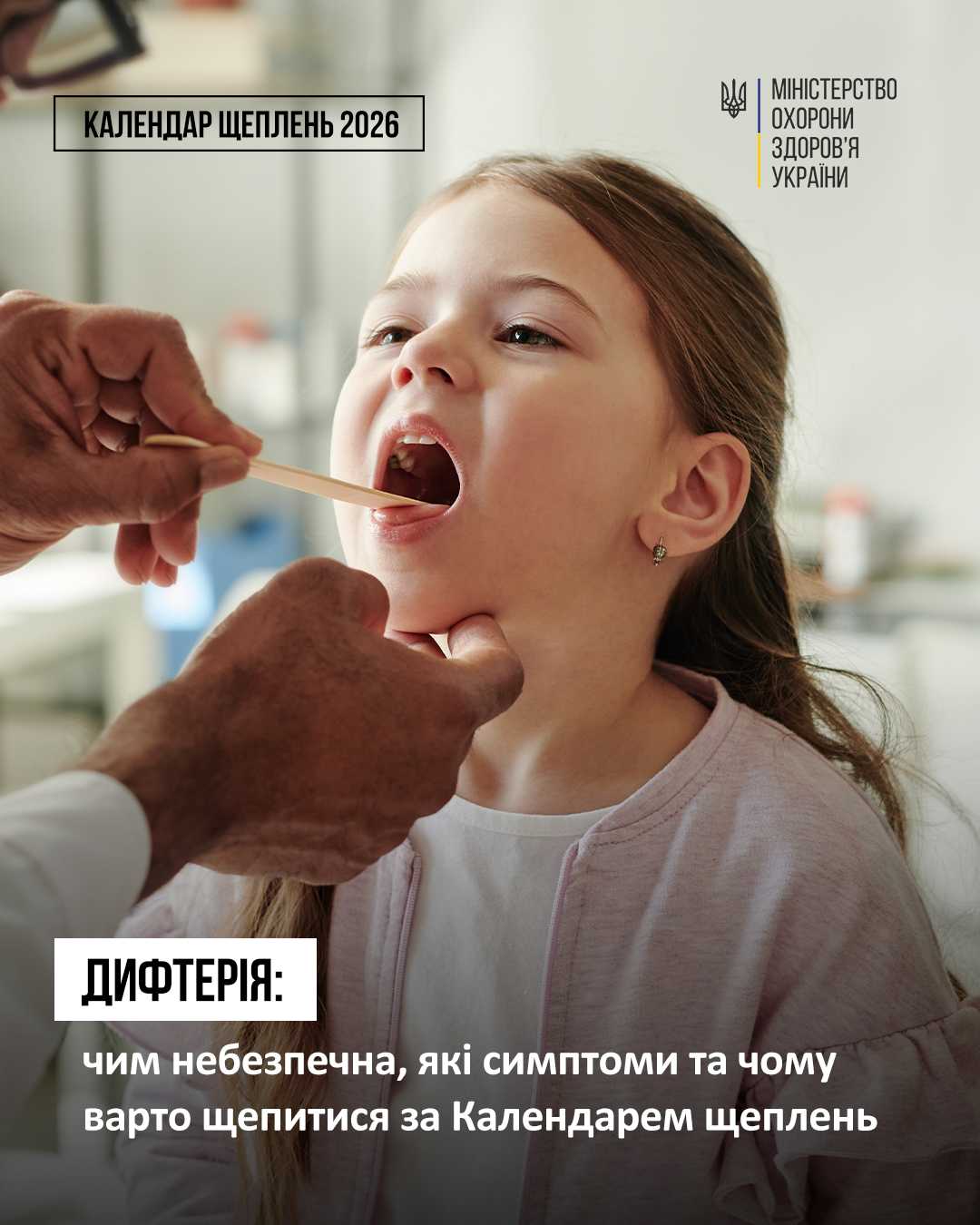 Дифтерія
